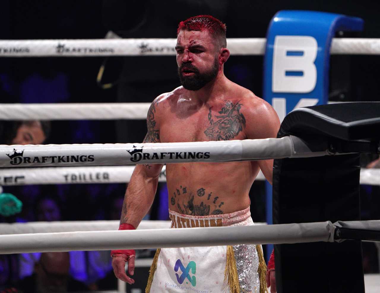 After the bare-knuckle fight against Michael Venom Page, Mike Perry, ex-UFC star, is no longer recognisable.