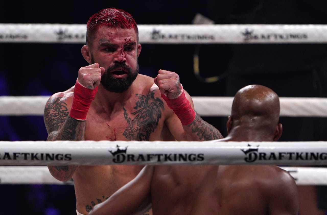 After the bare-knuckle fight against Michael Venom Page, Mike Perry, ex-UFC star, is no longer recognisable.