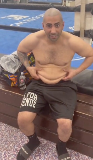 Meet Fousey from YouTube. He was injured in his debut boxing bout and had to have his body dramatically altered after sustaining a broken nose.