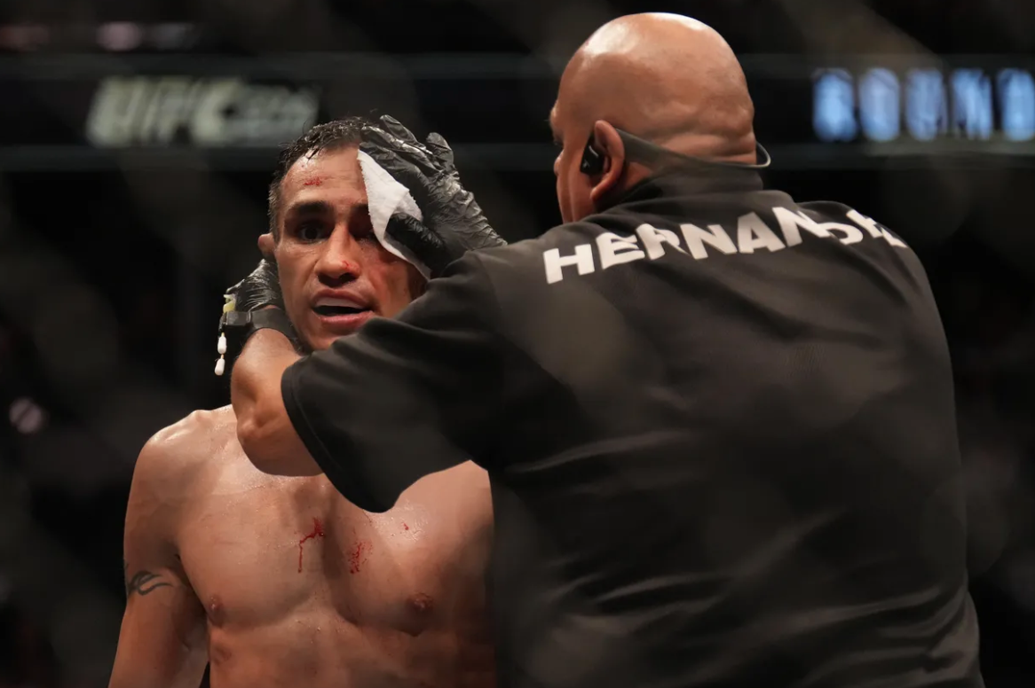 Tony Ferguson says he can't recall anything from the aftermath of Michael Chandler KO, ahead of UFC 279 return