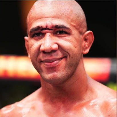 UFC star Greg Rodrigues gets a severe cut to his forehead, but he still wins the fight in Vegas.