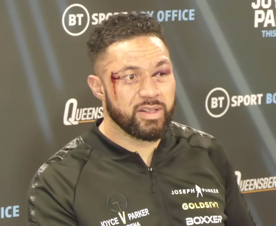 After the 11th round Joe JoyceKO, Joseph Parker's face is battered and bruised. Kiwi said that he was a horrible fighter.