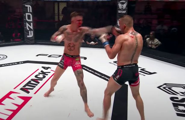 After a bloodbath that left their faces swollen, and with stitches in their eyes, MMA fighters are hard to recognize.