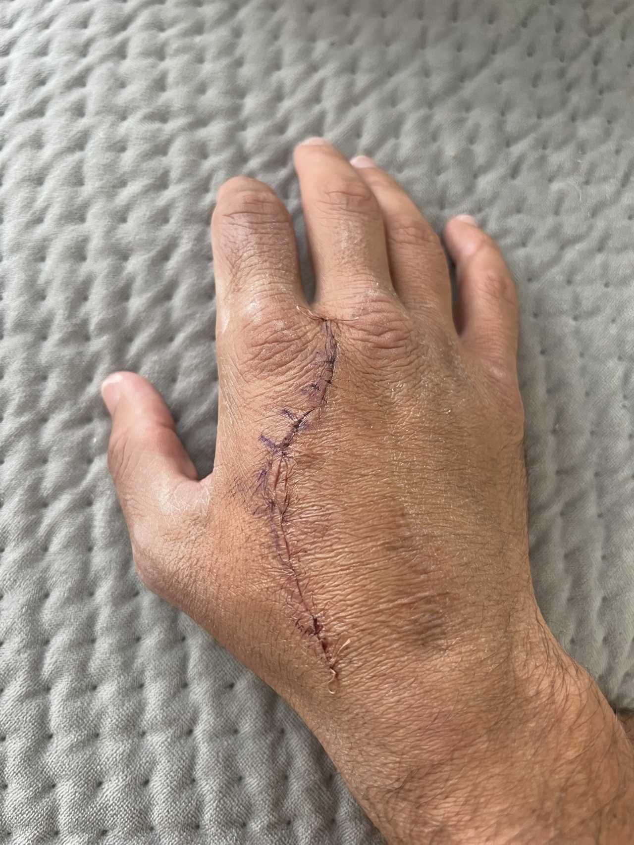 I've been robbed - Joe Cordina is stripped of the world title, without making a single defense due to hand injury.