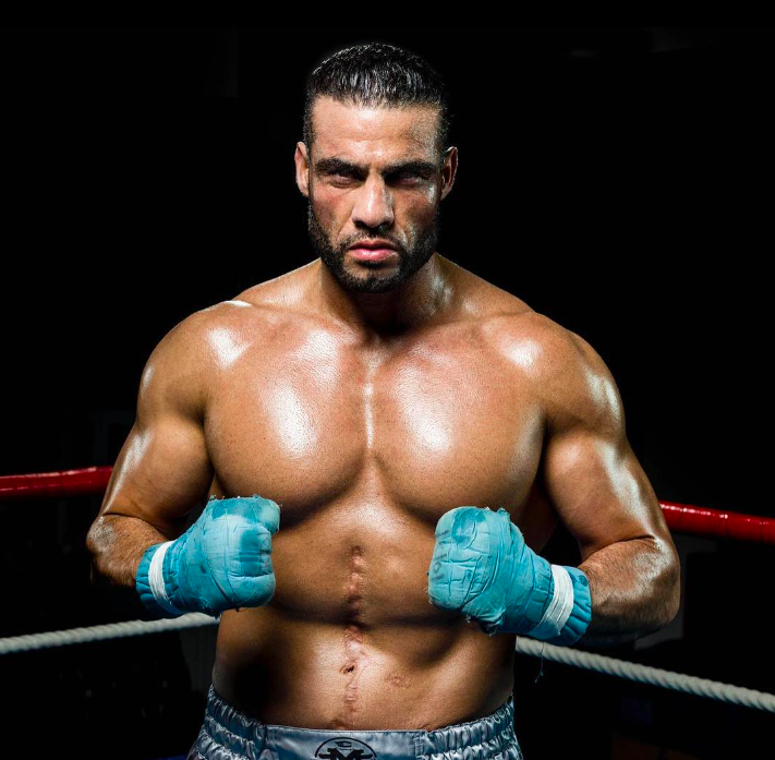 After being shot, I survived an assassination plot. I don't fear Tyson Fury, and I will KO him.