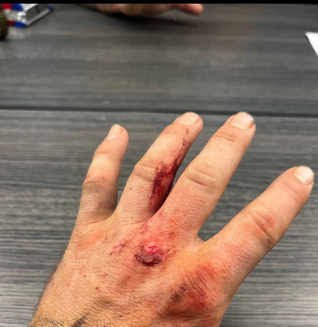 Conor McGregor's battered and bloody hand is visible after filming his film debut ahead UFC return next year