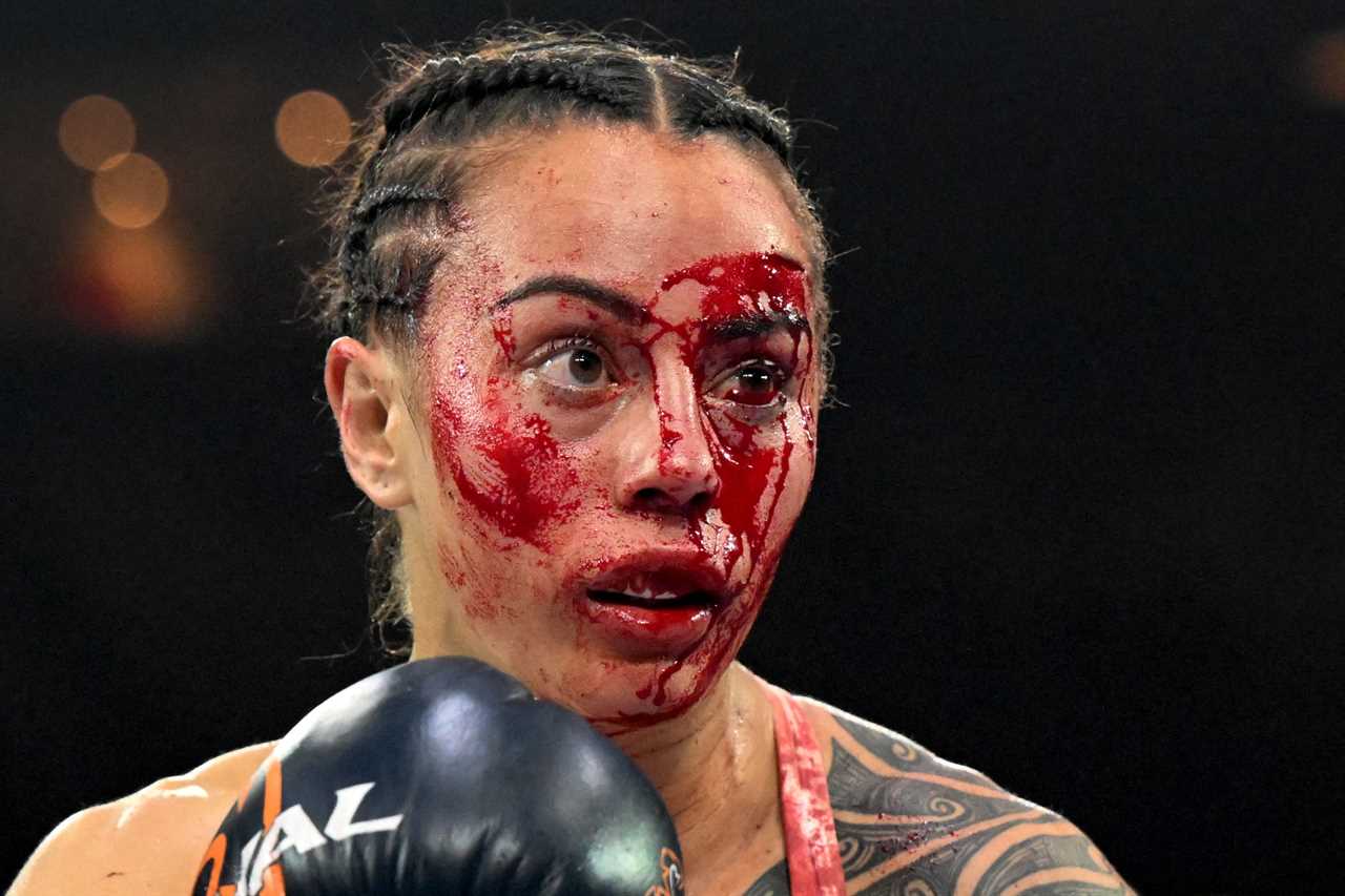 World champion Cherneka Johnson displays horror gash after brutal war with Susie Ramadan and is left bloodied