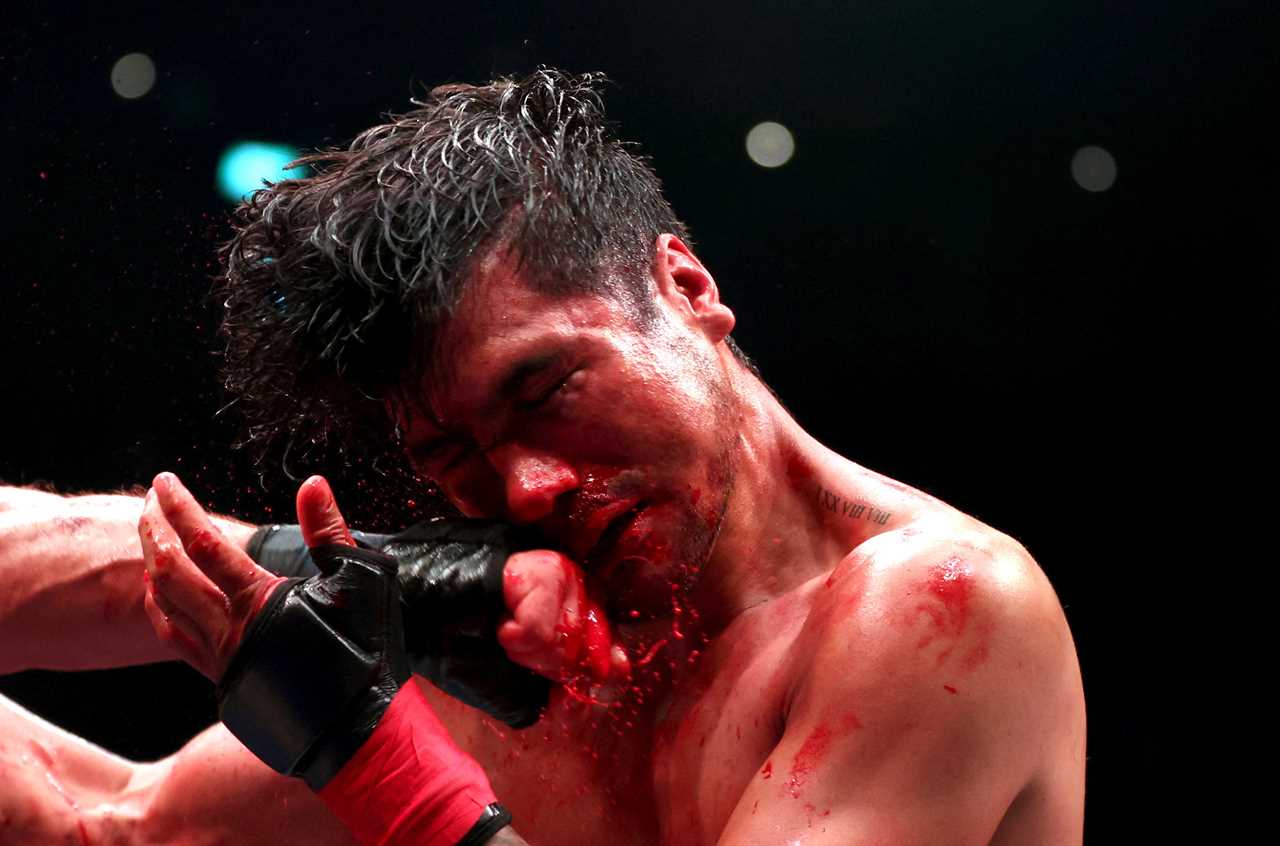 After brutal bloodbath fights, naked-knuckle boxers display horror injuries such as swollen eyes and gruesome cuts
