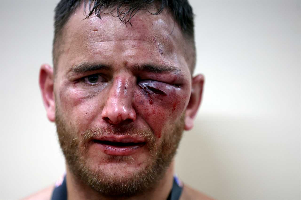 After brutal bloodbath fights, naked-knuckle boxers display horror injuries such as swollen eyes and gruesome cuts