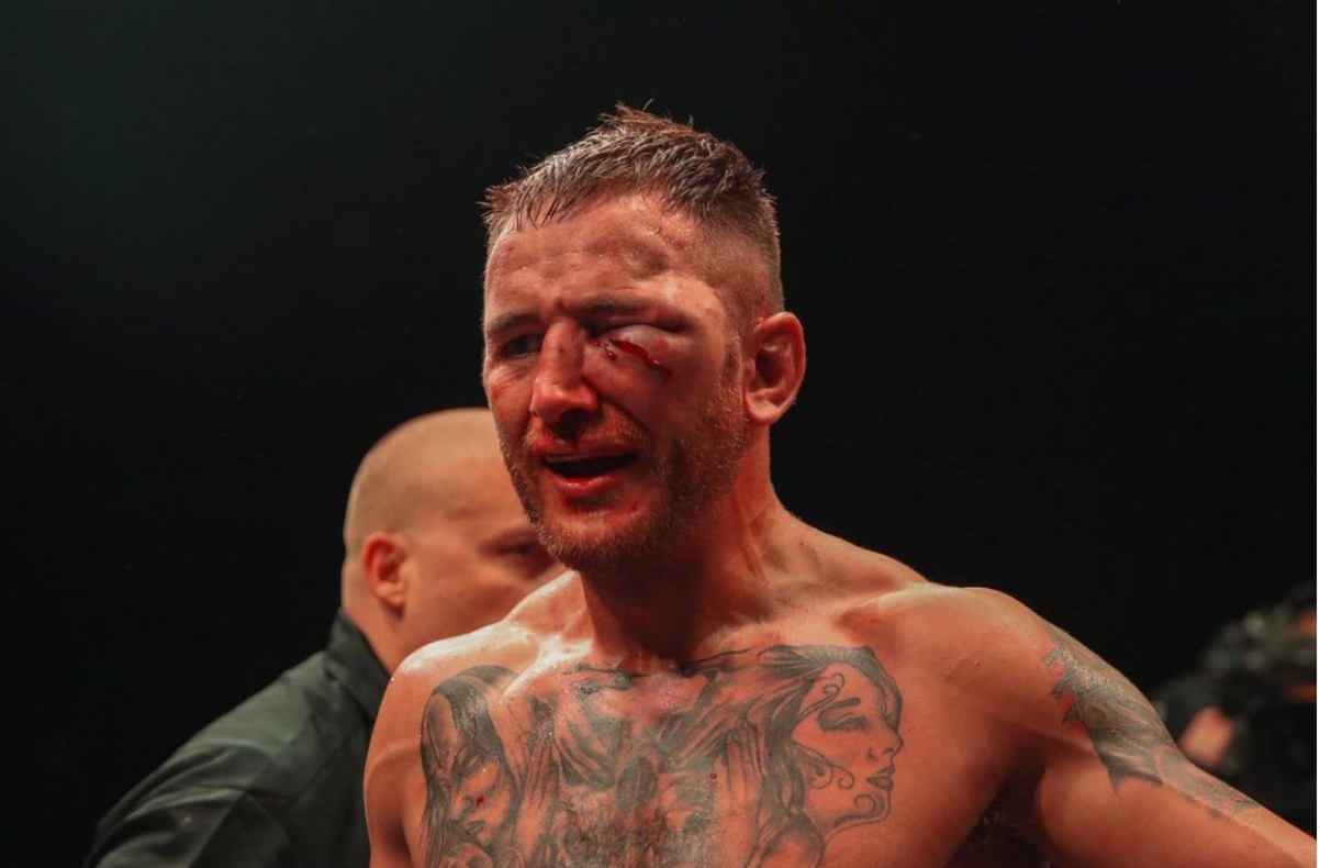 Bare-knuckle boxer Nathan Decastro looks unrecognisable after taking brutal beating as he shows off gruesome eye injury