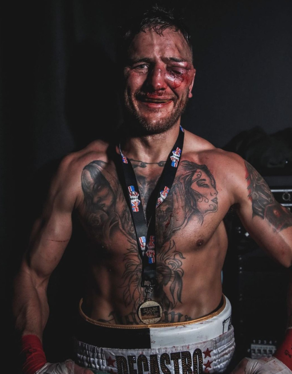 Bare-knuckle boxer Nathan Decastro looks unrecognisable after taking brutal beating as he shows off gruesome eye injury