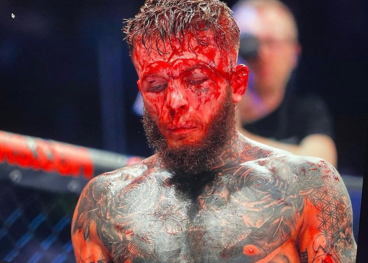 After suffering horrific facial injuries from bloodbath Cage Warriors 145, MMA star Jordan Vecunic isn't the same Jordan Vecunic.