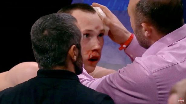 Danil Sharov, a kickboxer, suffers a terrible fractured skull from being kneed in the head. However, he miraculously tries to continue fighting.