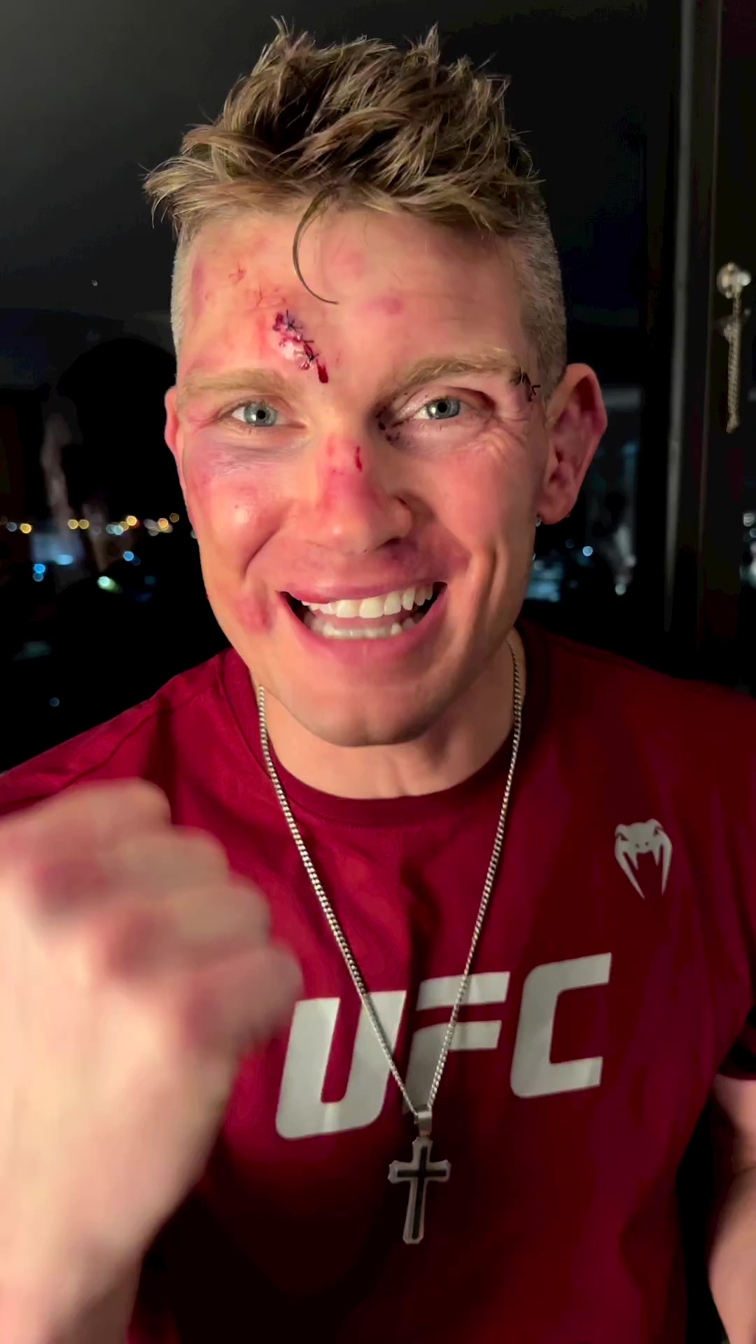 UFC stars Stephen Thompson & Kevin Holland display horrific battle scars, including broken hands and severe cuts