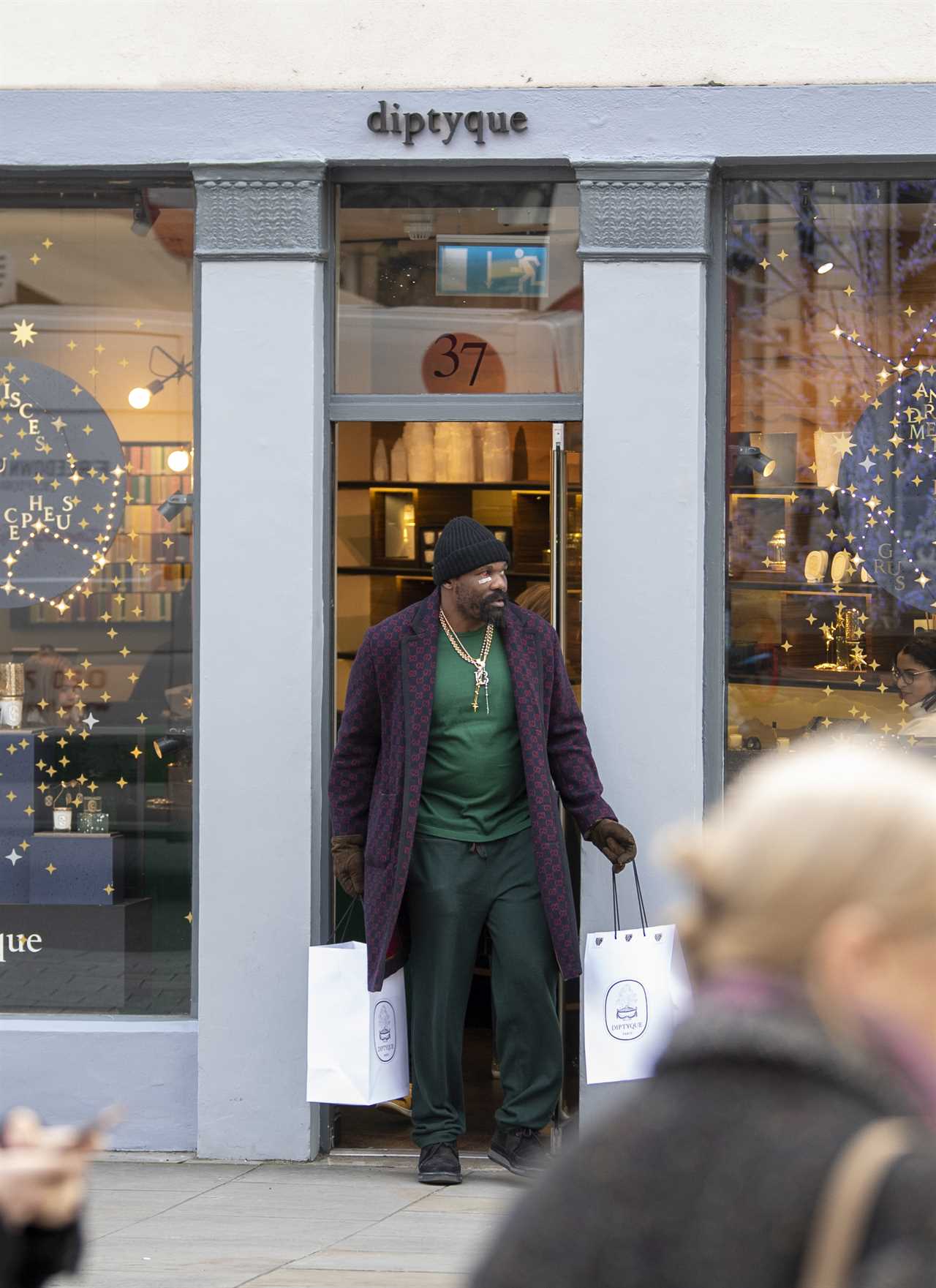 Derek Chisora, a manager shopping for scented candles, shows off his horrendous-looking eye injury from Tyson Fury defeat.