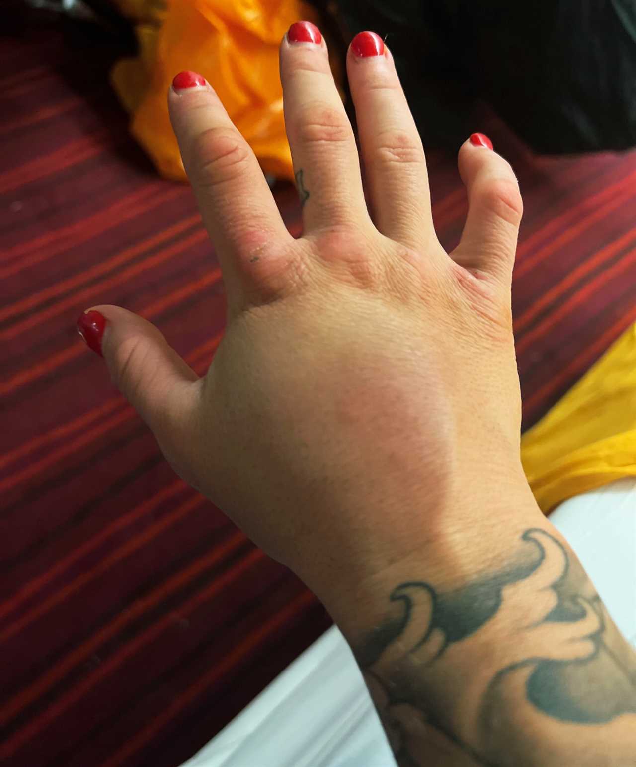 Ebanie Bridges reveals that she beat Shannon O'Connell using a BROKEN HANDS as she displays the gruesome injury