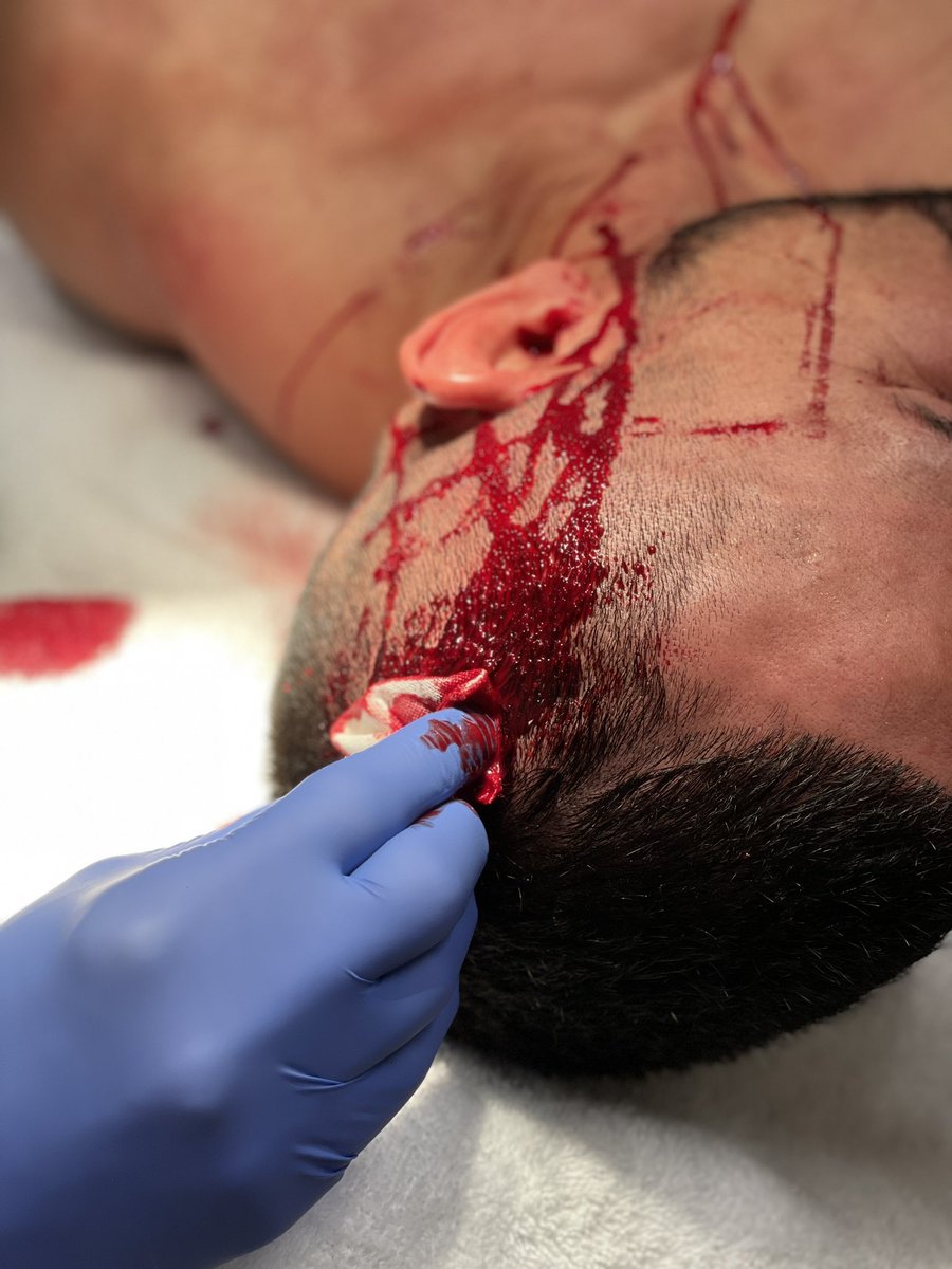 UFC fighter Garcia cuts an artery in his head during a fight, but still wins. It takes 2 hours for the medics to stop bleeding in horror scenes.