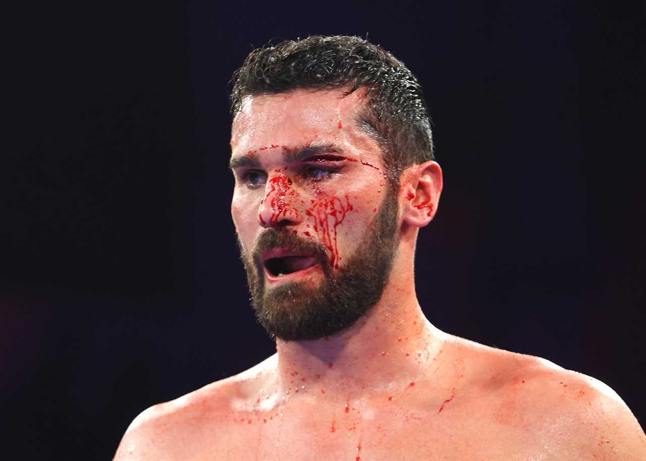 After suffering a horror cut, Boxer Guido Vianello was left bloody and covered in blood. He had previously broken the unbeaten boxer record.