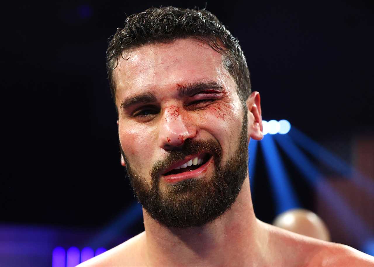 After suffering a horror cut, Boxer Guido Vianello was left bloody and covered in blood. He had previously broken the unbeaten boxer record.