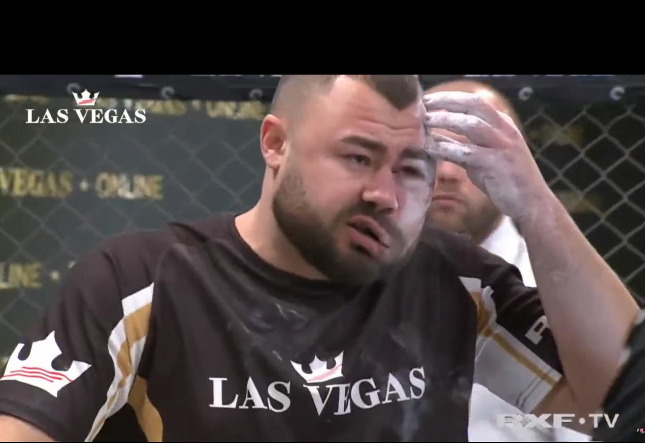 After a brutal Slap Fight, Conor McGregor of UFC leaves a man with a horrendous disfigured face.