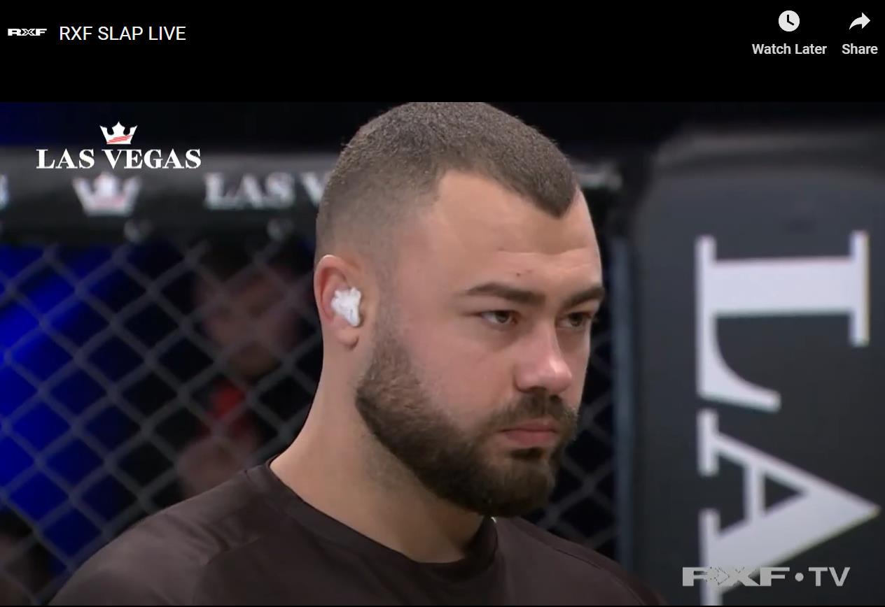 After a brutal Slap Fight, Conor McGregor of UFC leaves a man with a horrendous disfigured face.