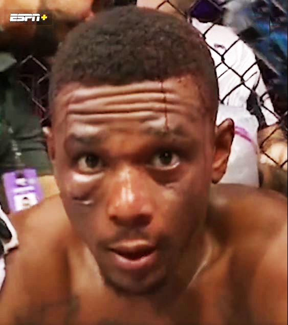 UFC fans shocked by the gruesome amount blood that poured off Jamahal Hill's face in Teixeira win.