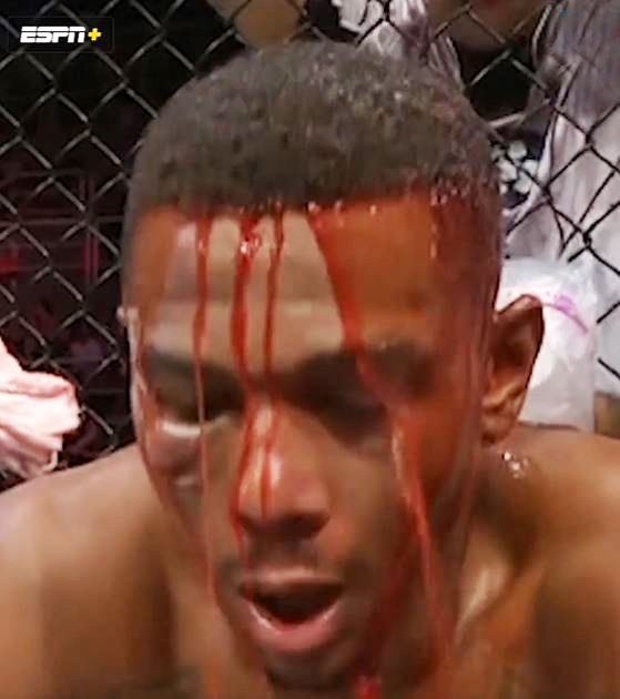 UFC fans shocked by the gruesome amount blood that poured off Jamahal Hill's face in Teixeira win.