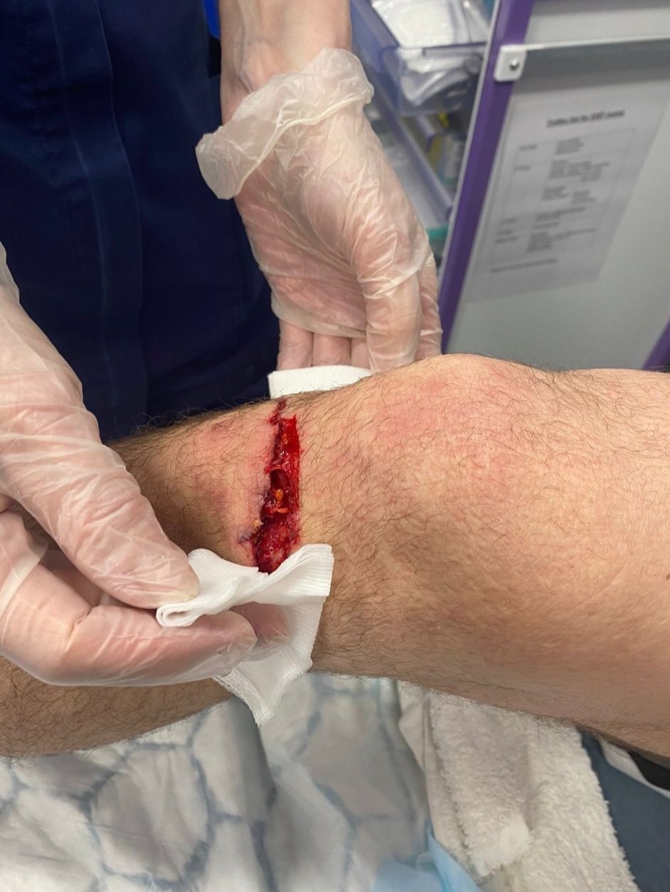 After suffering a freak accident, UFC 286 London fight is cancelled for a massive star.