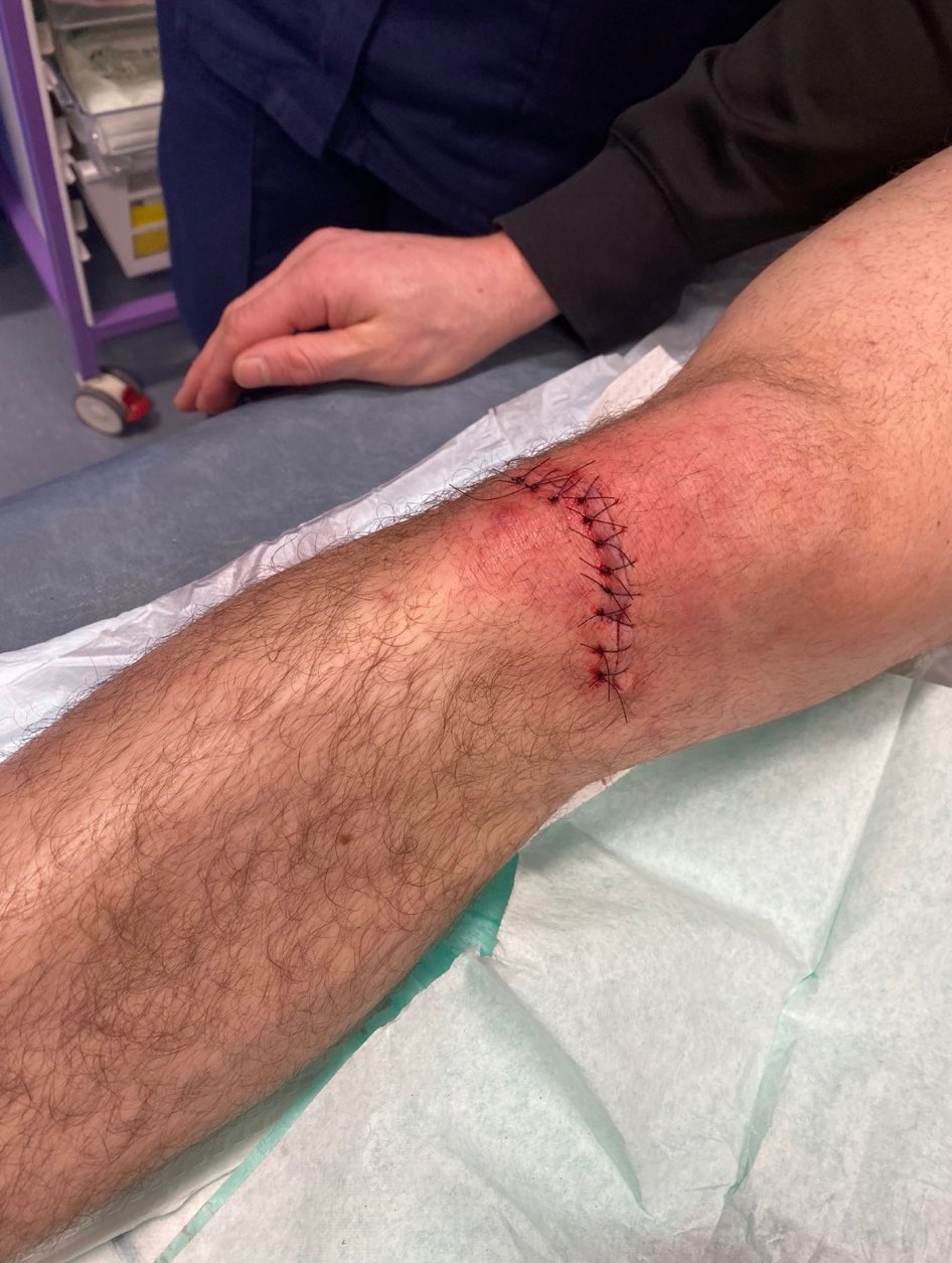After suffering a freak accident, UFC 286 London fight is cancelled for a massive star.