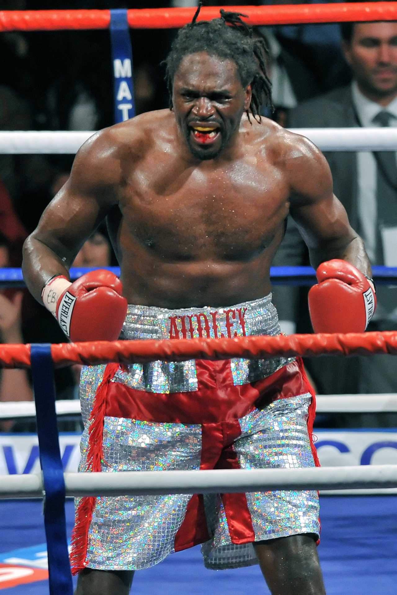Deontay Wilder and David Haye knocked me out, but none more than Nigerian Nightmare.