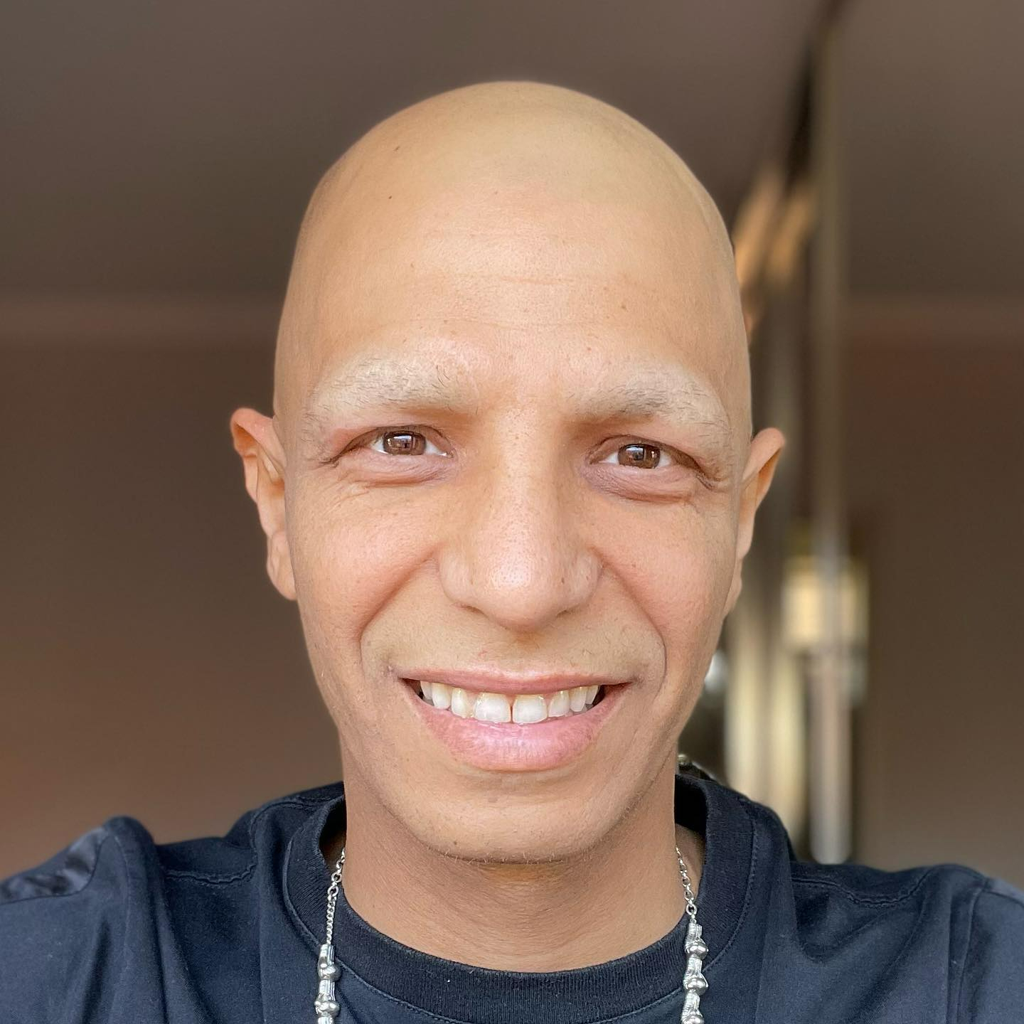 Ex-Boxing World Champion, I fought Amir Khan. I miraculously beat cancer despite telling doctors I was dying.