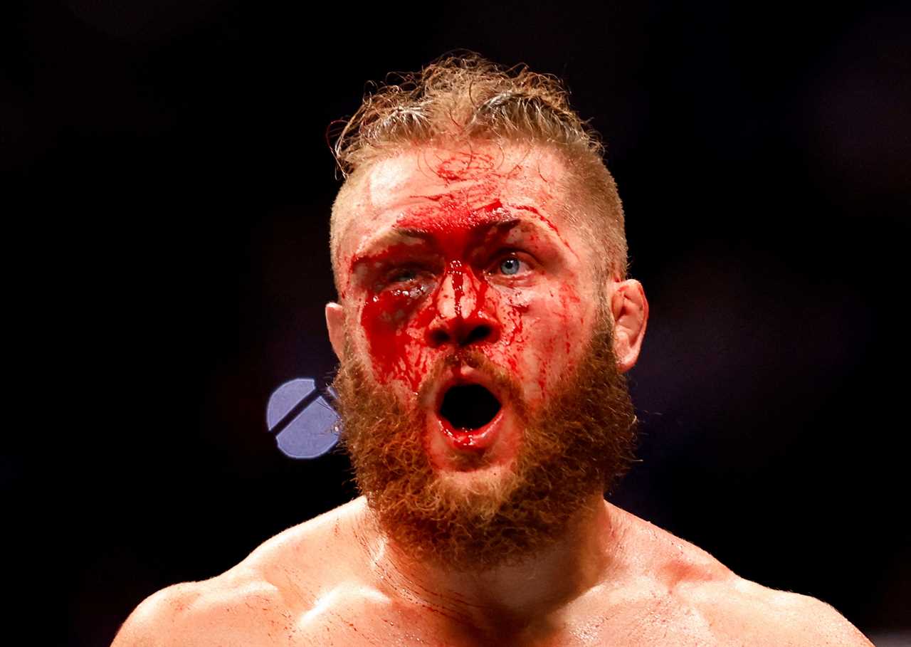 UFC star Rafael Fiziev, shows Justin Gaethje his battered and bloodied face after a war.