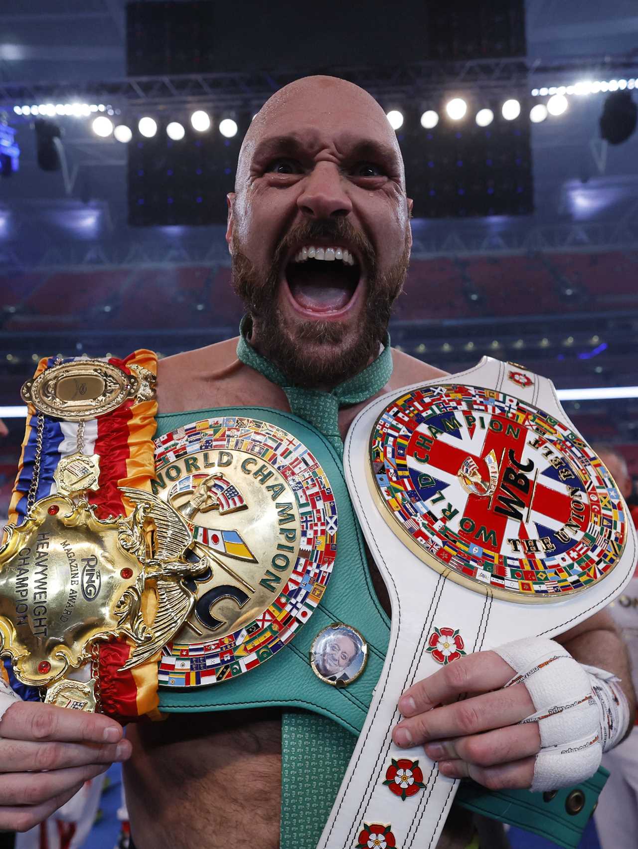 Tyson Fury is told by Anthony Joshua to shut the F*** up and fight after he won on ring return in order to create a Brit blockbuster