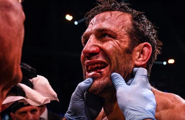 After having his teeth knocked out, ex-UFC champ Luke Rockhold leaves brutal bare-knuckle battle with Mike Perry