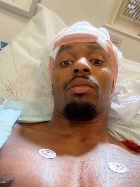 UFC star Lerone Murphry shares graphic photo of himself with a horrific head injury and 'almost bleed out' after a car crash