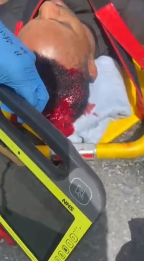 UFC star Lerone Murphry shares graphic photo of himself with a horrific head injury and 'almost bleed out' after a car crash