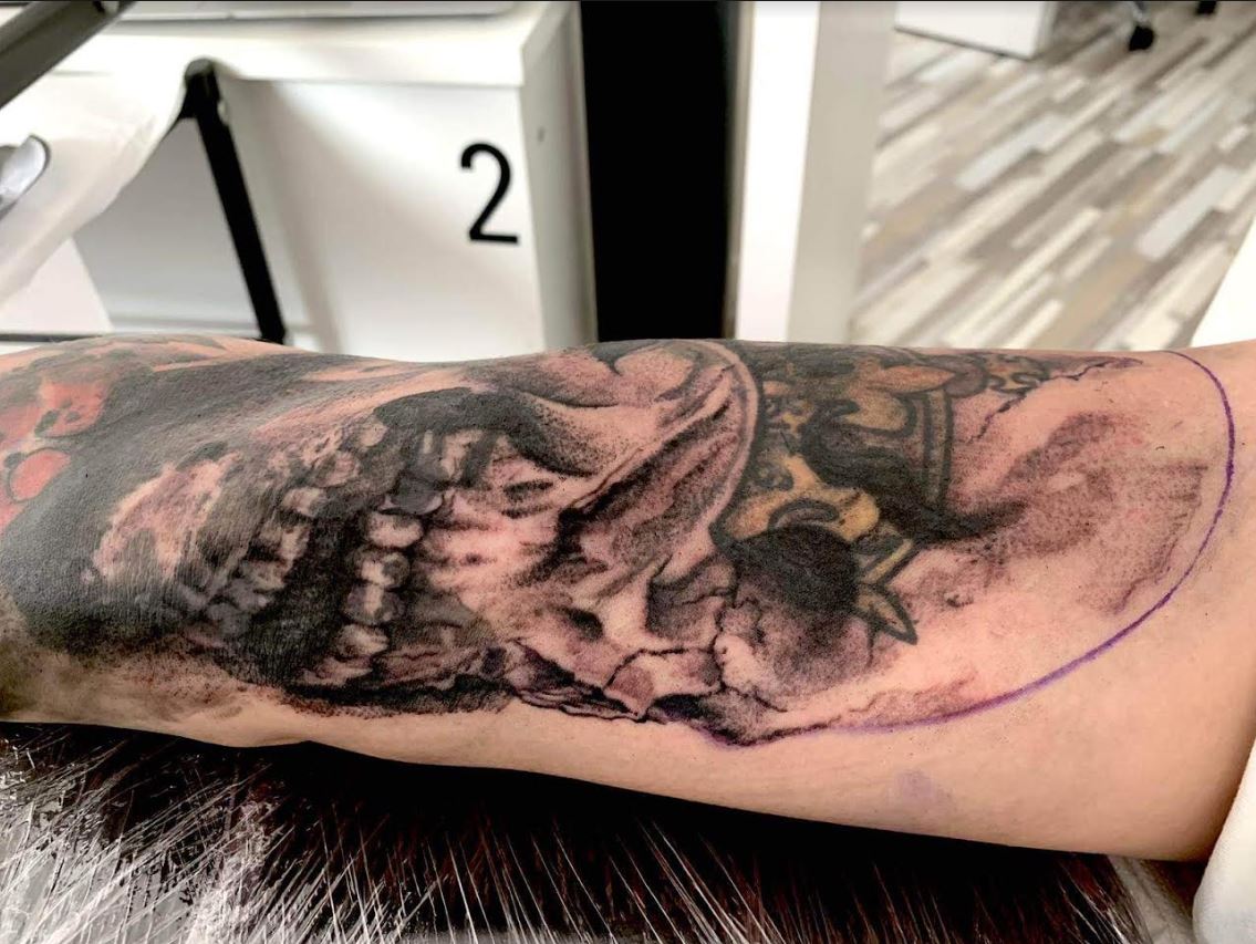 I was targeted by online trolls over beloved Tyson Fury tattoo – now I’m getting rid of it because of something he did