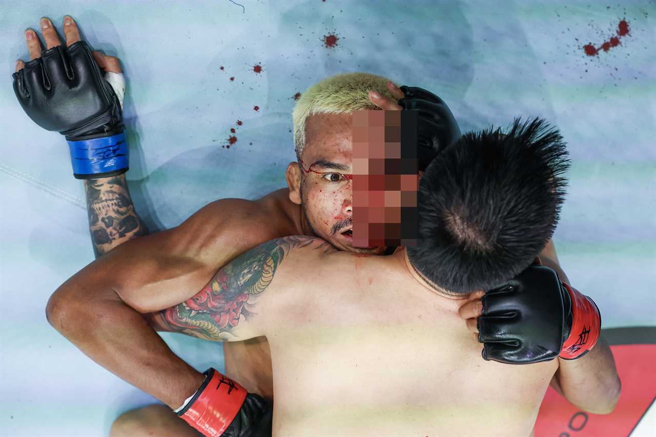 MMA star with blood on his face after horrific eye gouge injury
