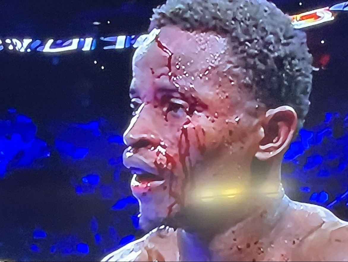 Boxing match STOPS after fighter receives horrific head injury, leaving him with blood dripping down his face