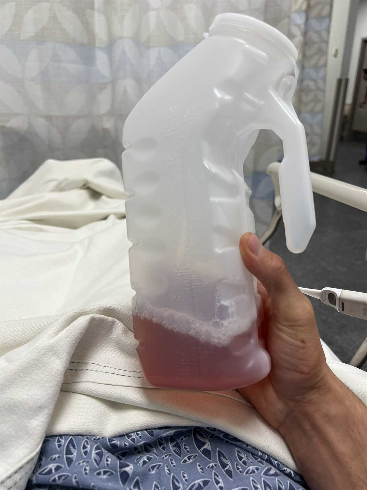 UFC fighter hospitalised after being repeatedly kicked in the groin, with swollen testsicles and peeing BLOOD