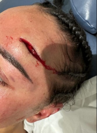 Cherneka Sugar Neekz Johnson has put a gruesome injury to her head behind her and is now ready for Ellie Scotney.