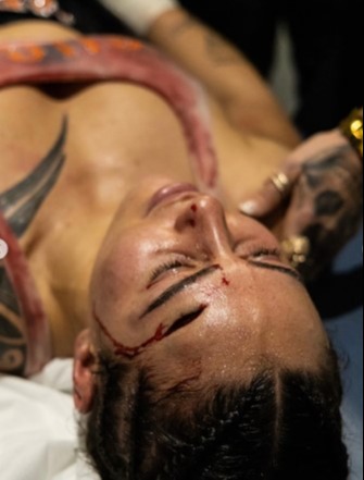 Cherneka Sugar Neekz Johnson has put a gruesome injury to her head behind her and is now ready for Ellie Scotney.