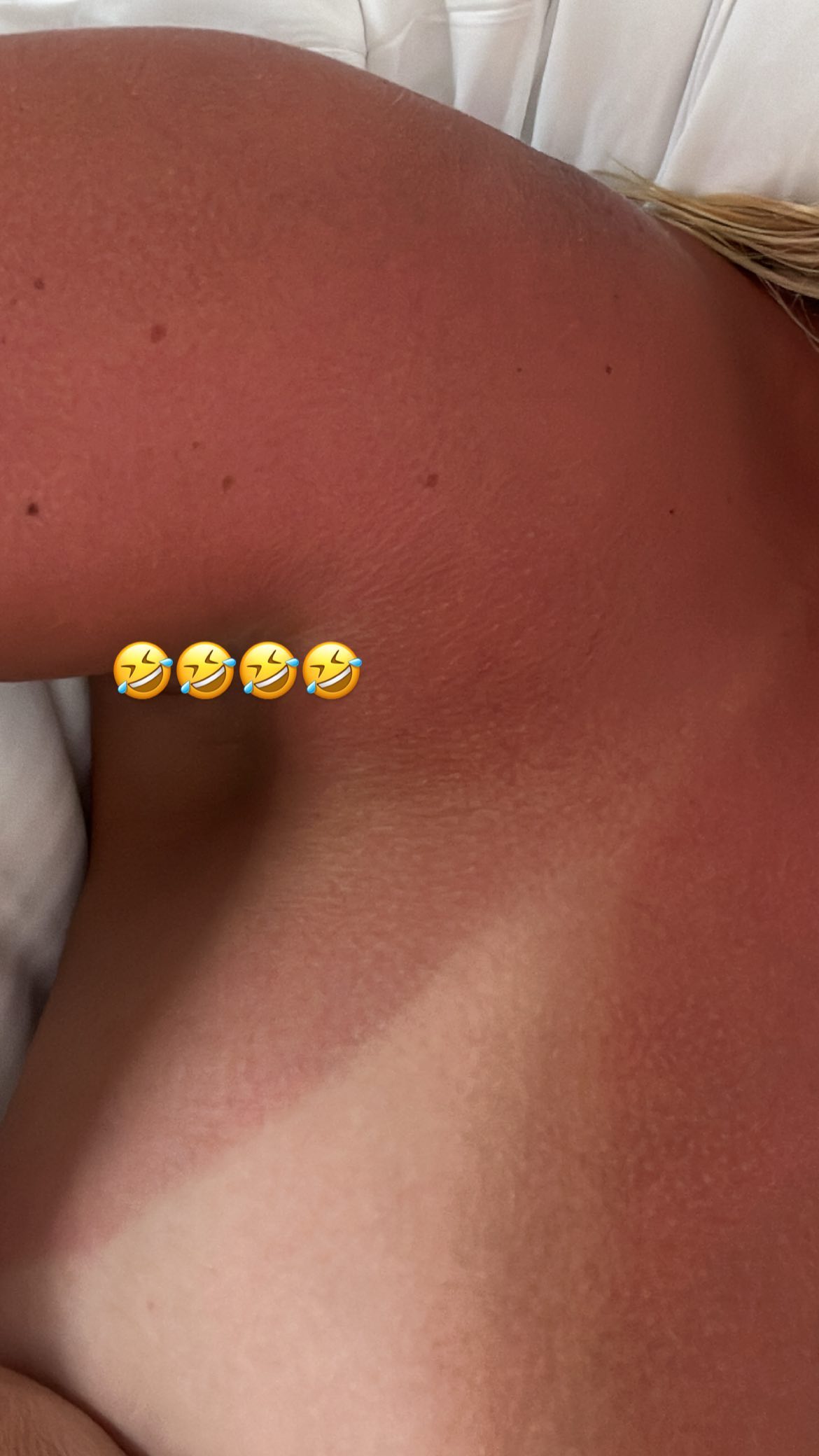 Apollonia Lewellyn, a boxing ring girl who is a sexy and a thong-wearing beauty, shows off her bare top to expose sunburned skin.