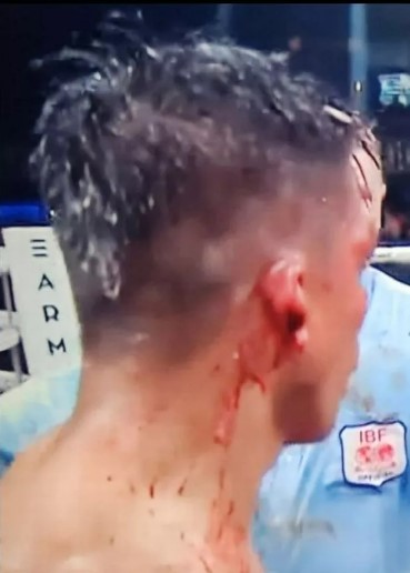 Boxing fans are horrified to see blood splattered on the ringside camera after a fighter's ear EXPLODES during a brutal fight