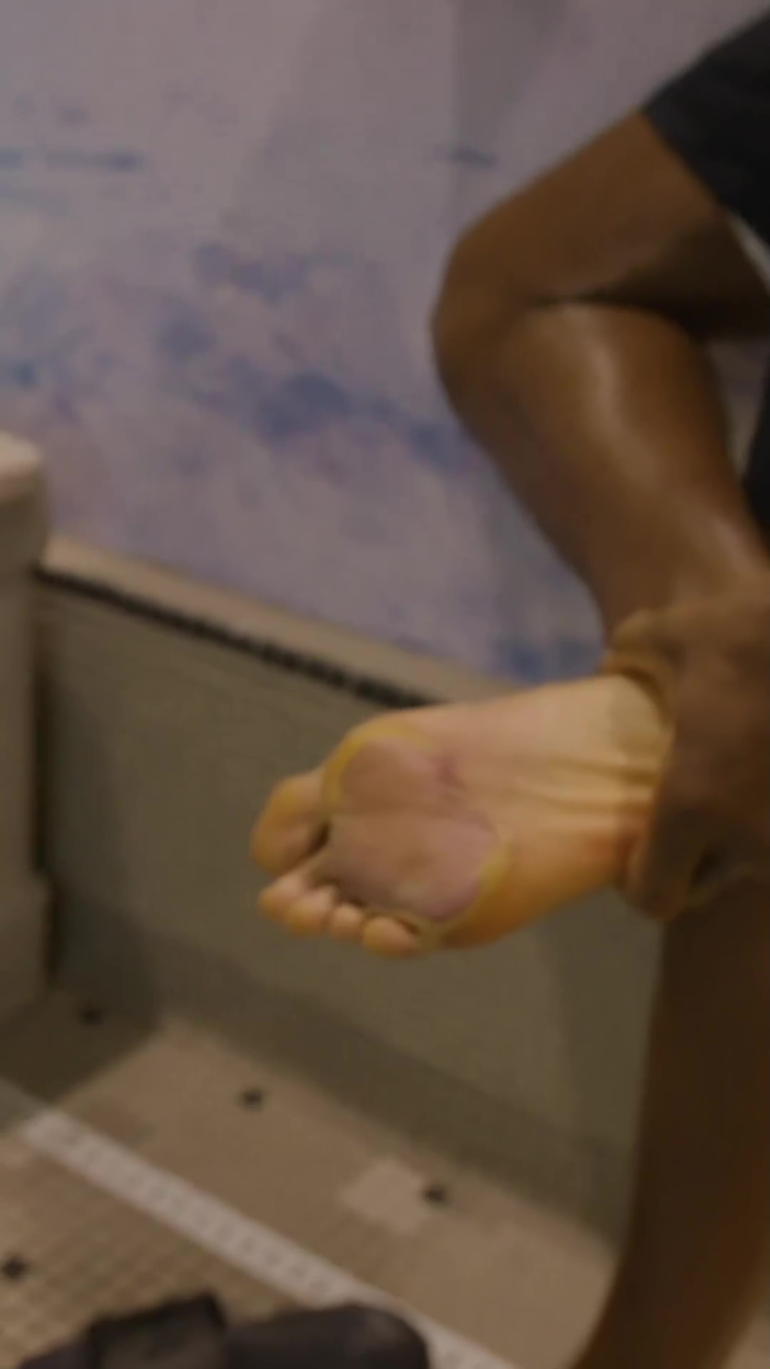 Anthony Joshua shows off blisters and a 'peeling' skin as a result of his brutal training.