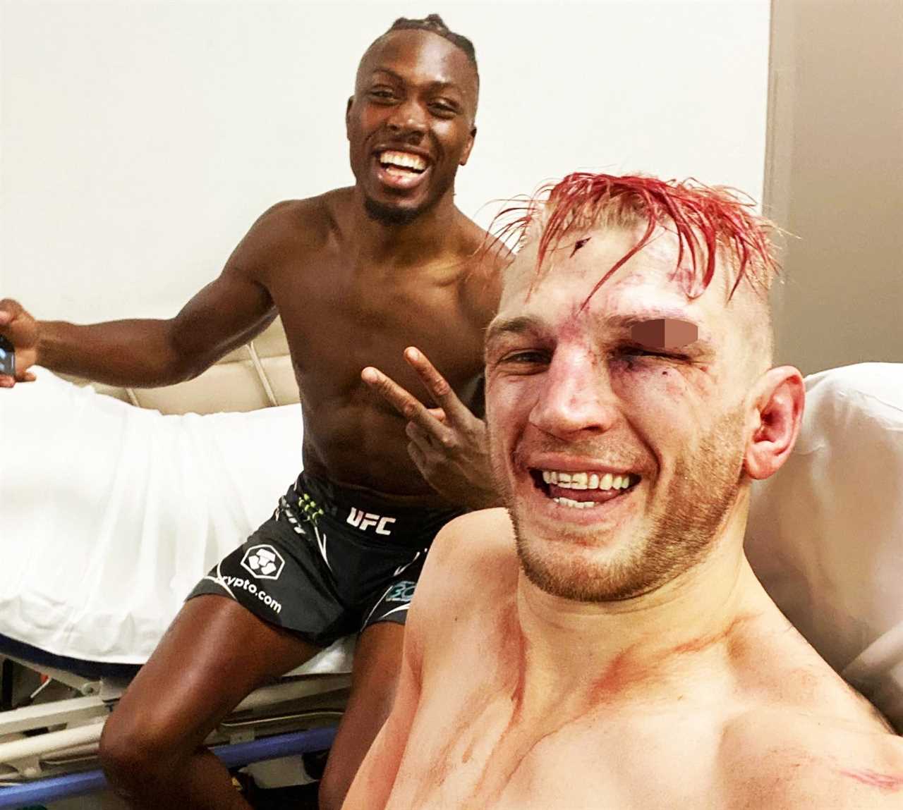 UFC star with a bloodied arm suffers horrific head injury and a broken arm, but still smiles.