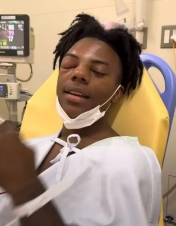Ishowspeed gives an update after emergency surgery on a mystery eye injury