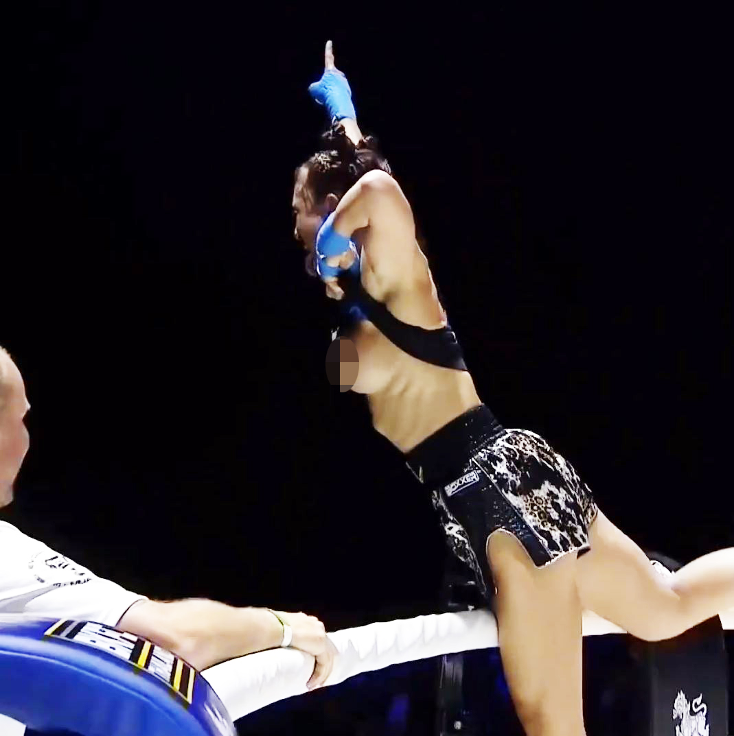 BKFC Fighter Tai Emery removes breast implants after health scare