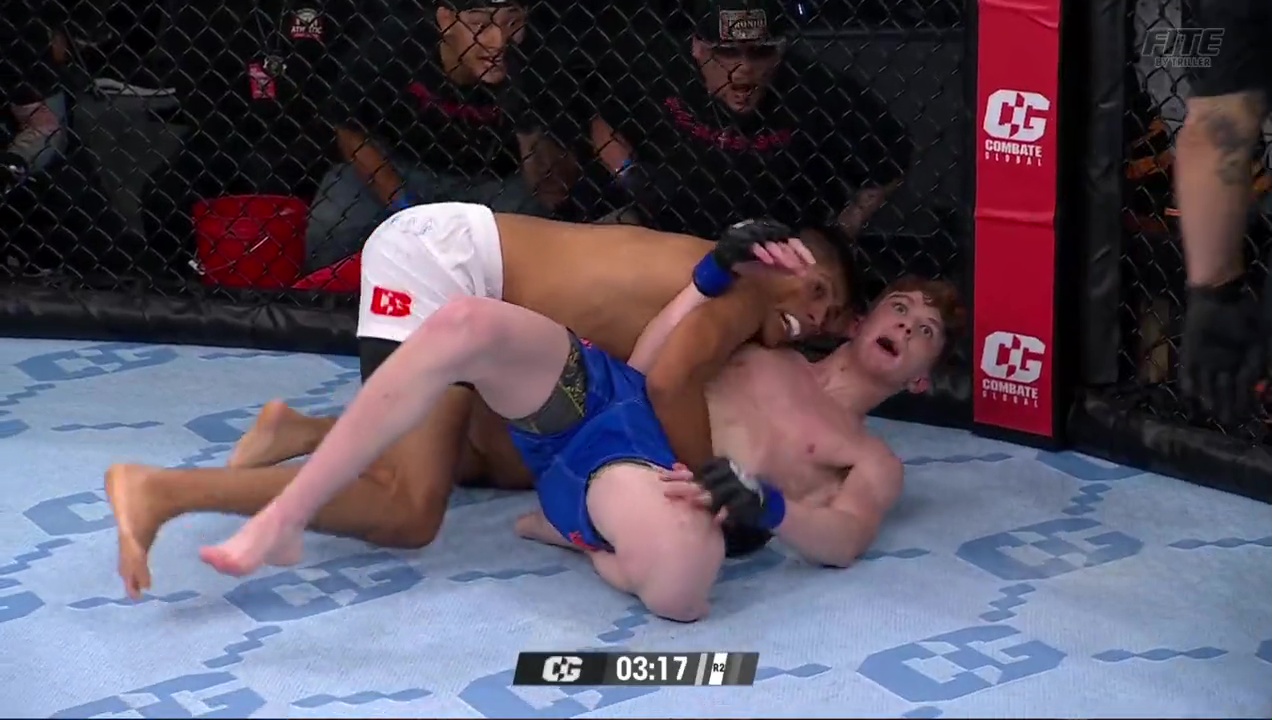 The MMA fighter who suffered the 'worst injury in history'