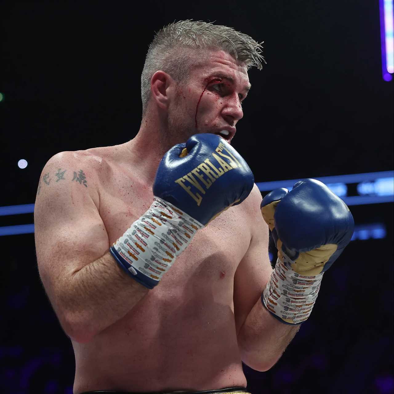 Liam Smith has a horrific cut on his left side after the Chris Eubank Jr. rematch